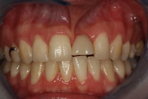 Img 0422 yhsggk - Eugenol