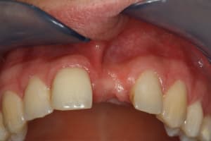 Img 0424 gmo5vo - Eugenol