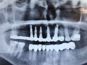 Img 0591 judfdu - Eugenol