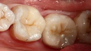 Img 0705 ooohta - Eugenol