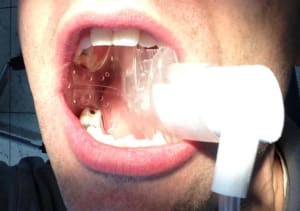 Img 0714 zupfip - Eugenol