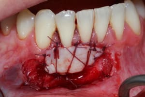 Img 0739 xg5ze6 - Eugenol