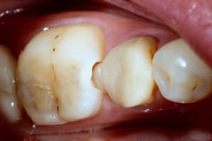 Img 0752 abxdda - Eugenol