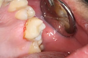 Img 0874 lnqnq1 - Eugenol