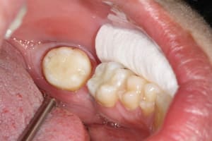 Img 0892 uyeuge - Eugenol