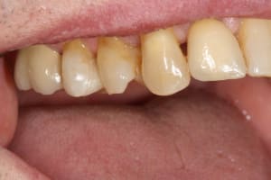 Img 0907 if8dru - Eugenol