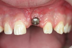 Img 0913 cvvqul - Eugenol