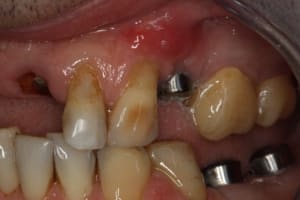 Img 0997 tdfsk8 - Eugenol