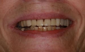 Img 1015 cslakg - Eugenol