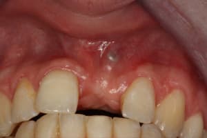Img 1065 ochucd - Eugenol