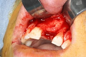 Img 1072 tgunjj - Eugenol