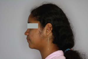 Img 10 nregu4 - Eugenol