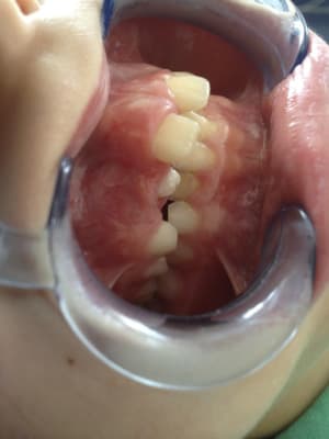 Img 1153   2014 08 01   13 53 14 uymf95 - Eugenol