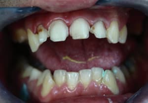 Img 1182 l0sdis - Eugenol