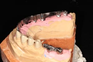 Img 1188 r4hkjo - Eugenol