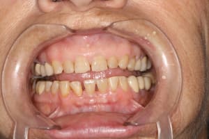 Img 1199 gnaa05 - Eugenol