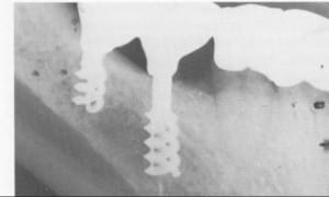 Img 1242 pklray - Eugenol