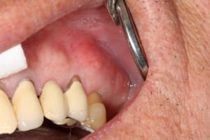 Img 1253 fybqpg - Eugenol