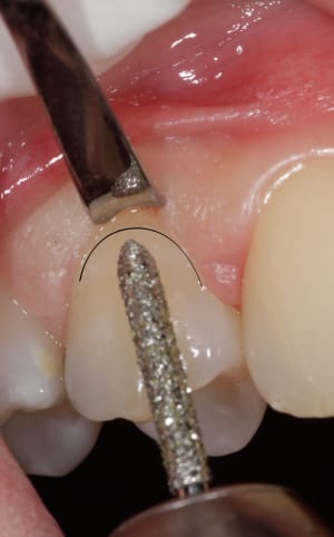 Img 1268 ukagt3 - Eugenol