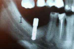 Img 1270 small wsibjk - Eugenol