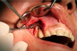 Img 1285 small git6fy - Eugenol