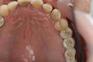 Img 1641 q1y5ap - Eugenol