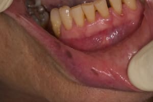 Img 1664 vql4ke - Eugenol