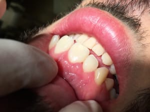 Img 1779 myupb5 - Eugenol