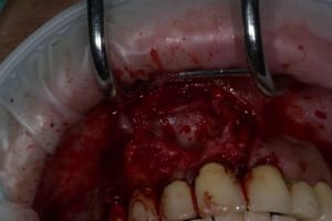Img 1815 anj2wf - Eugenol