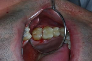 Img 1851 air44x - Eugenol