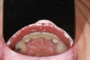 Img 1860 q3hq1a - Eugenol