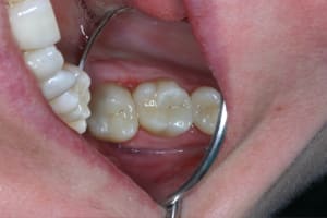 Img 1860 vuo3ky - Eugenol