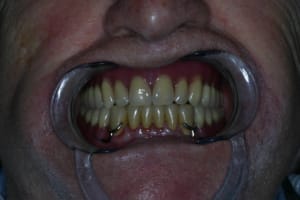 Img 1965 ksiofb - Eugenol
