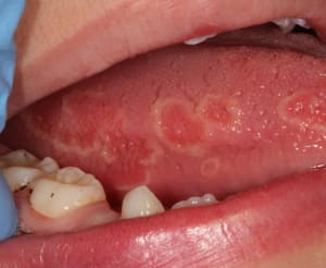 Img 1973 etazza - Eugenol