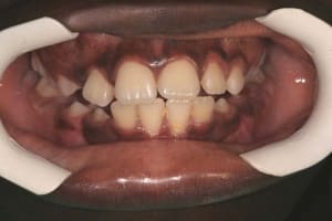 Img 1 pimare - Eugenol
