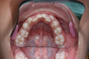 Img 1 rmdcvy - Eugenol