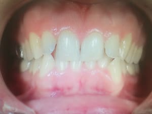 Img 20171129 145702 s6onn2 - Eugenol