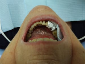 Img 20181126 155819 pqodlw - Eugenol