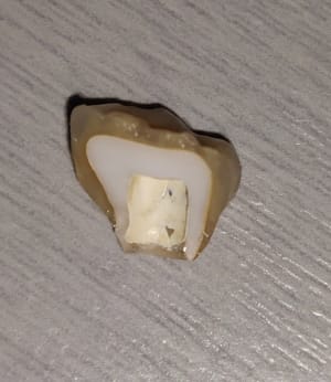 Img 20190524 132903  01 xcoesw - Eugenol