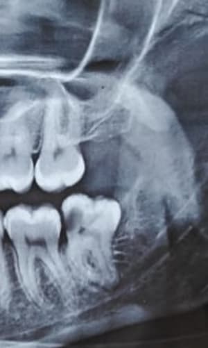 Img 20200808 000232 dljc8y - Eugenol