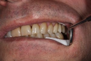 Img 2051 d7awwc - Eugenol