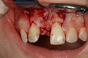 Img 2076 prawls - Eugenol