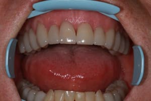 Img 2107 ox83wk - Eugenol