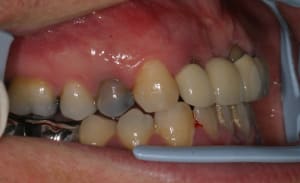Img 2218 qvfw63 - Eugenol