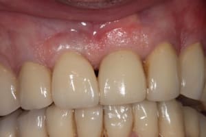 Img 2218 uycpja - Eugenol