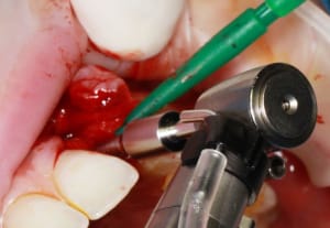 Img 2239 v0oaez - Eugenol