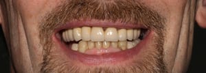 Img 2616 sourire wzrllm - Eugenol