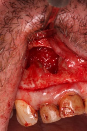 Img 2716 edmegg - Eugenol