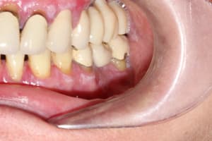 Img 2719 fenstr - Eugenol