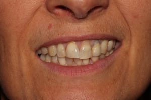 Img 2750 lpxlxt - Eugenol